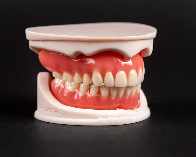 3D printed Lucitone™ dentures