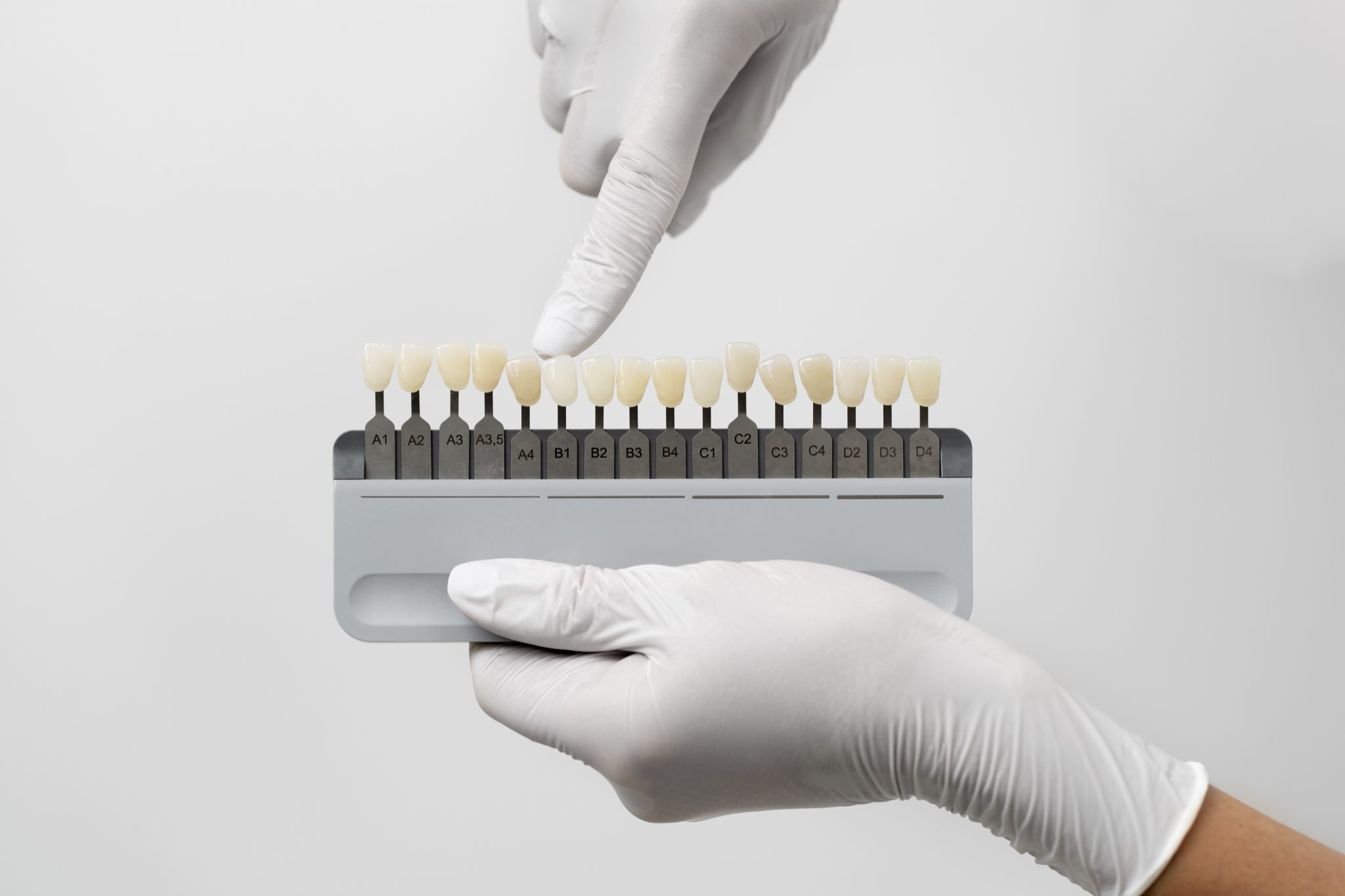 Dental Implants - Dentek Digital